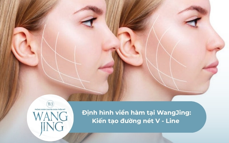 Định hình viền hàm