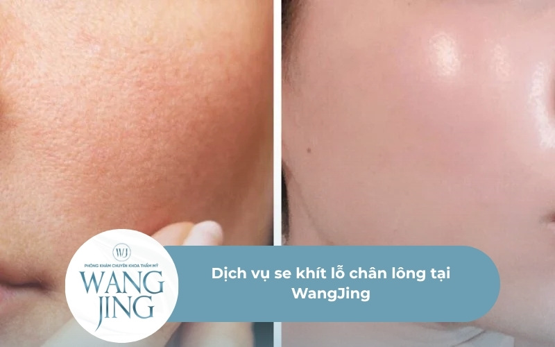 Se khít lỗ chân lông