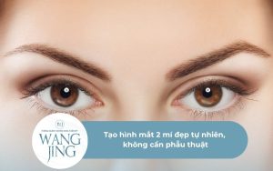 Tạo hình mắt 2 mí