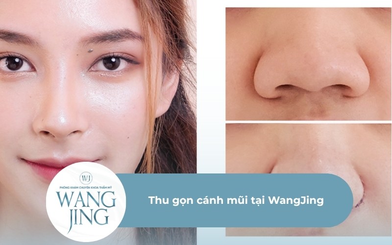 Thu gọn cánh mũi