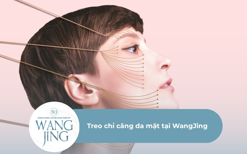Treo chỉ căng da mặt